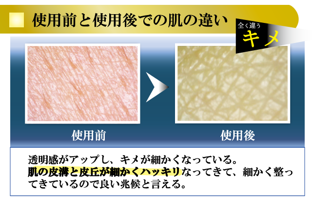 使用前と使用後での肌の違い キメ